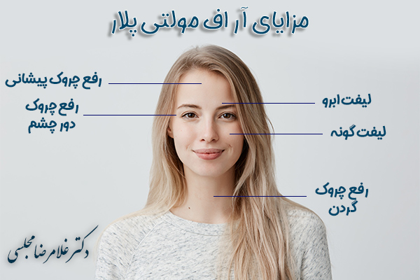 مزایای ار اف مولتی پلار