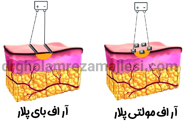 تفاوت آر اف مولتی پلار و آر اف بای پلار